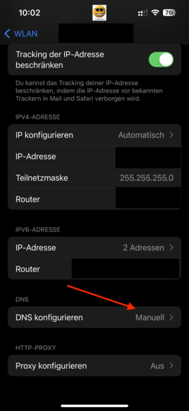 DNS konfigurieren