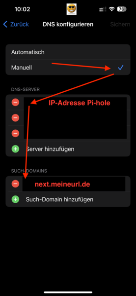 DNS konfigurieren
